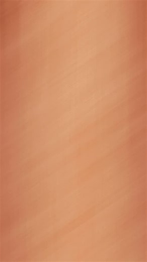 Dra. Alice Brandão on Instagram: "Hoje compartilho aqui um artigo super interessante que li. Ele fala sobre a distinção entre leiomiomas benignos e sarcomas uterinos antes da cirurgia é um dos maiores desafios na prática ginecológica. Este estudo prospectivo, conduzido no Institut Curie entre 2016 e 2022, avaliou o papel da biópsia percutânea uterina guiada por imagem, combinando análise microscópica e array-CGH (hibridização genômica comparativa) para identificar malignidade em tumores suspeito