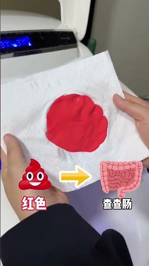 Top 5 Poop Colors You Should Never Ignore: Identify Your Health Issues