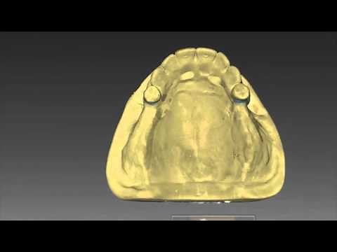 inLab SW 15 Partial Frameworks