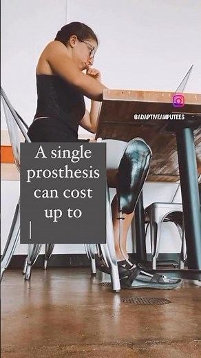 The SHOCKING Cost of My Prosthetic Leg (Let's Debate!)