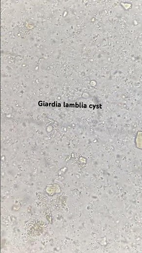 Giardia lamblia cyst #laboratory #giardia #parasite