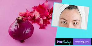 5 Ways You Can Use Onion Peels To Cure Acne & Pimples | Herzindagi