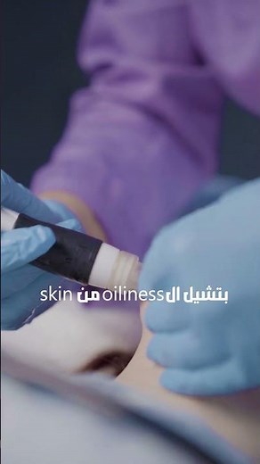 Benefits of Microdermabrasion!