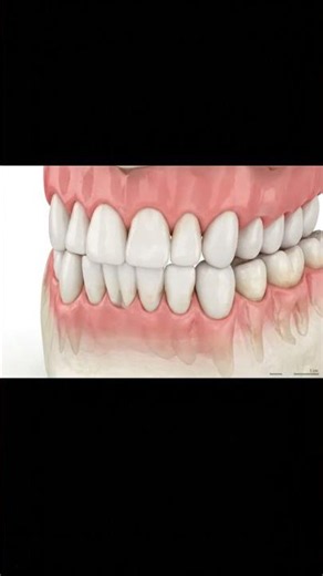 Types of Teeth Explained in 3D 🦷 Incisors, Canines, Molars & Wisdom Tooth |Dental Basics#3ddental#3d