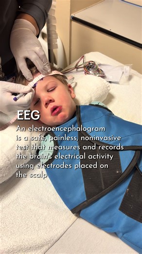 New experience unlocked. EEG - An electroencephalogram is a safe, painless, noninvasive test that measures and records the brain's electrical activity using electrodes placed on the scalp. It is primarily used to diagnose epilepsy, seizures, sleep disorders, head injuries, and brain diseases.