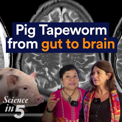 156K views · 1.1K reactions | Have you heard about a worm that can...