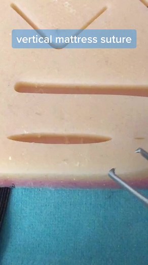 Mastering the Art of Suturing: A Step-by-Step Guide