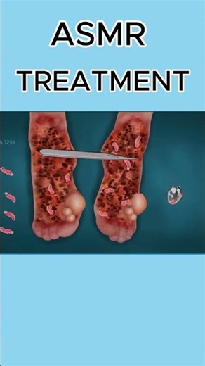 ASMR foot treatment #uk doctor 🏥 #animation #relax #satisfying