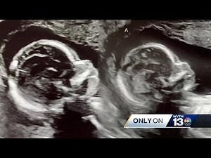Ala. Woman with Double Uterus Is Pregnant and Expecting a Baby in Both: It's 'Very, Very Rare'