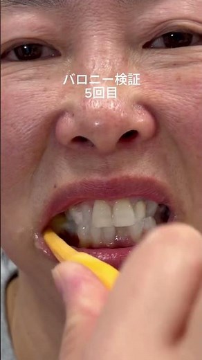 話題のホワイト歯磨き粉徹底検証🔥7日でこの変化はやばかった‼️980円で買えるリンクはプロフのページに載せました🔗#垢抜け #ホワイトニング #アラフォー #歯磨き粉 #美容 PR