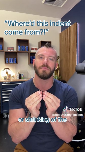 Steroid injections are commonly used to reduce inflammation and shorten the healing time of cystic acne lesions. Unfortunately, they can sometimes cause a tiny indent in the skin from an injector using too much or too concentrated of a dose into the lesion. The good news is they are temporary and you can speed up the process with in-office treatments! If you have an angry zit you need injected or an indent caused from a previous injection, then shoot me a DM or schedule an appointment online and