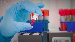 Severe COVID symptoms rarer in kids, but they do happen