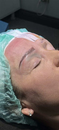 Transplantace obočí: Petra a její úžasná proměna