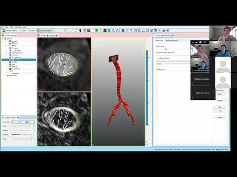 SimVascular Tutorial 4: Machine Learning 2D Segmentation