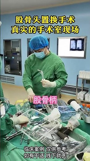 髋关节置换假体展示-Hip replacement prosthesis display #科普 #doctor