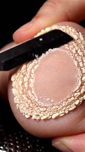 Foot ASMR Relaxation | Satisfying Callus Clean