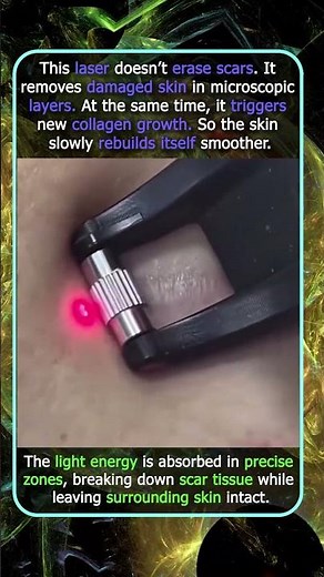 How Lasers Actually Reduce Scars