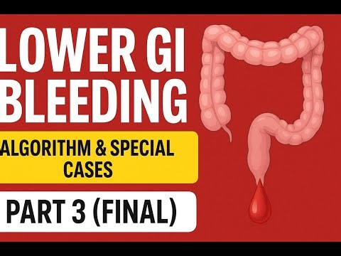 Lower GI Bleeding Part 3 | Final Special Cases, Complications & Algorithm ‪@amplemedicallectures‬