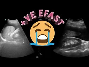 LEVEL 1 | EFAST | positive findings