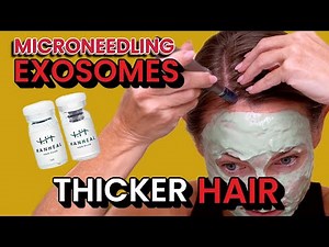 Microneedling Scalp with A7 using the Hanheal Hair Fill