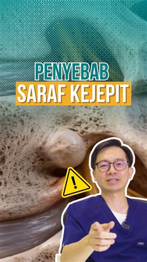 PENYEBAB SARAF KEJEPIT