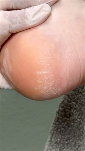 Watch this heel get smooth with a sanding cap #nails #pedicure