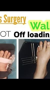 After Brachymetatarsia Surgery Walk || Using modified DARCO Forefoot Offloading Shoes/ Dr. Khaqan