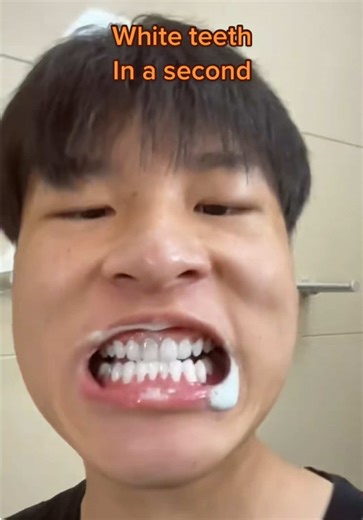 Can You Really Whiten Your Teeth In SECONDS?! 😮🦷 #teeth #dentist #mouth