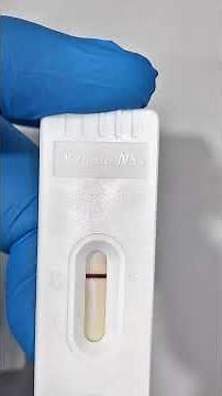 Teste de Dengue NS1 #biomedicina #analisesclinicas #medico