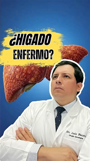 Symptoms that indicate a diseased liver: Beware! #fattyliver