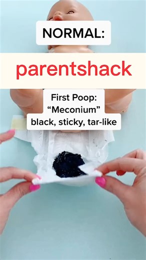 Parenting Pathways on Instagram: "Why Meconium Matters for Newborns A baby’s first poop, called meconium, is black, sticky, and tar-like. It’s completely normal and a sign that your newborn’s digestive system is working properly. Passing meconium helps clear waste from the womb and makes way for regular stools. Delayed or absent meconium could indicate digestive issues, so always check with your pediatrician if you have concerns!"