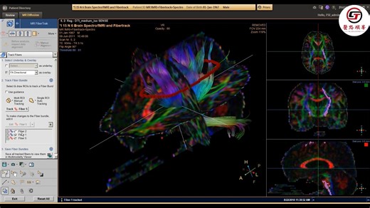星云工作站Diffusion和DTI分析