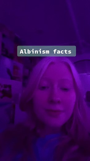 Understanding Albinism: Facts and Insights
