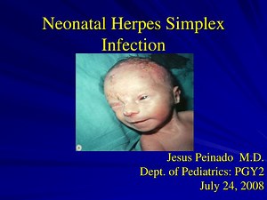 PPT - Neonatal Herpes Simplex Infection PowerPoint Presentation, free download - ID:3425950
