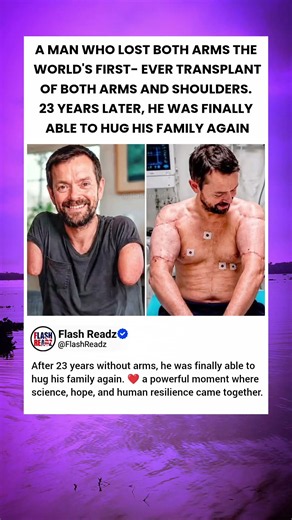 man receives world's first double arm and shoulder transplant ❤️ | emotional medical miracle