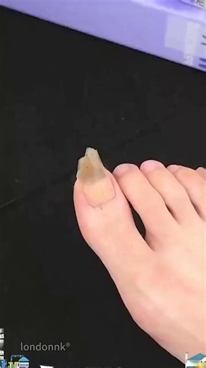 💅 2-in-1 Electric Nail Trimmer & Polisher - Salon-Perfect Nails at Home! ✨ ✂️ All-in-One Magic - Trim, shape & polish in one sleek device! 💡 Built-in LED Light - See every detail clearly, no more messy clippings! 🔇 Whisper-Quiet & Gentle - Perfect for babies, kids, and sensitive souls! ⚡ 2-Speed Control - Adjust for delicate care or powerful polishing! 👵 Ergonomic & Safe - Designed for all ages, from infants to grandparents! 😍 "No more salon bills! My nails look professionally done in minut