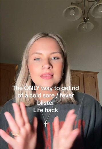 Cure Cold Sores Fast: The Only Trick You Need