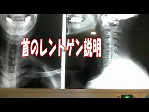 首のレントゲンの説明