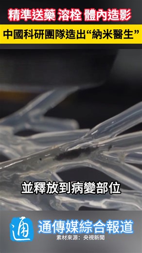 100萬個機器人都藏在指甲蓋裡？！中國深圳市人工智能與機器人研究院研發的磁控微納機器人，單個體積小於0.1微米，指甲蓋大小的團簇可容納約100萬個。這些機器人具備磁響應能力，可通過外部磁場實現精準導航，像“快遞員”一樣將藥物直接送達病變部位，誤差僅頭髮絲的十分之一。（通傳媒綜合報道） | 通傳媒