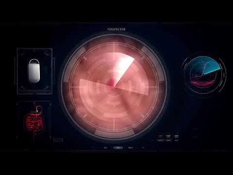 NaviCam Stomach System