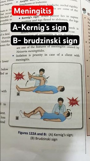 kernig’s sign and brudzinski sign of meningitis #nervoussystem #nursing #shortvideo #exam #trending