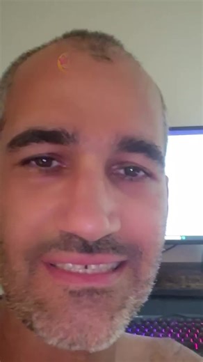 👉 I used to feel ashamed every time #Tourette’s showed up in public. Now I just let it happen... I built this voice journaling app to help me process moments like that. #TouretteSyndrome #VoiceJournal #MentalHealth #UnfilteredHealing #NeurodivergentVoices