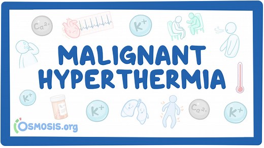 Malignant hyperthermia: Video & Meaning | Osmosis