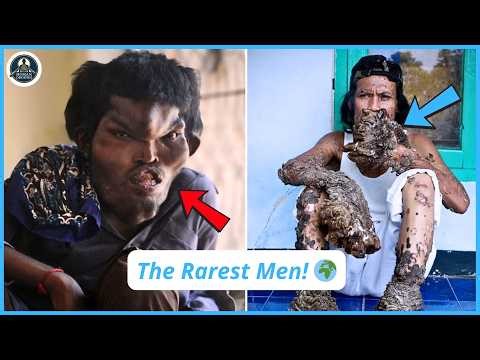 15 Men With The Most Unique Appearances On Earth–The Mysteries Behind Their Jaw-Dropping Appearances