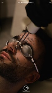 NaturaPeel es un innovador tratamiento de Láser Quanta System con resultados inmediatos, que combate los signos del envejecimiento cutáneo, como impurezas, poros abiertos y líneas finas. | Dr. Randall Herrera