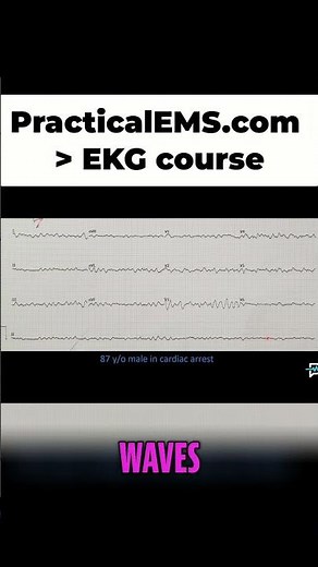 Cardiac Arrest: Know the Signs, Save a Life with Defibrillation! #shorts