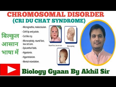 CRI DU CHAT SYNDROME , WHAT IS CRI DU CHAT SYNDROME