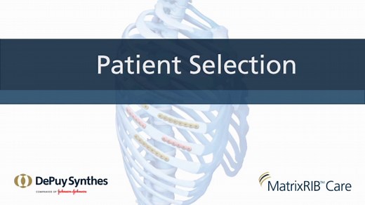 MatrixRIB™ Care Program | DePuy Synthes