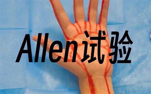 Allen试验，有彩蛋的教学，你不看吗？