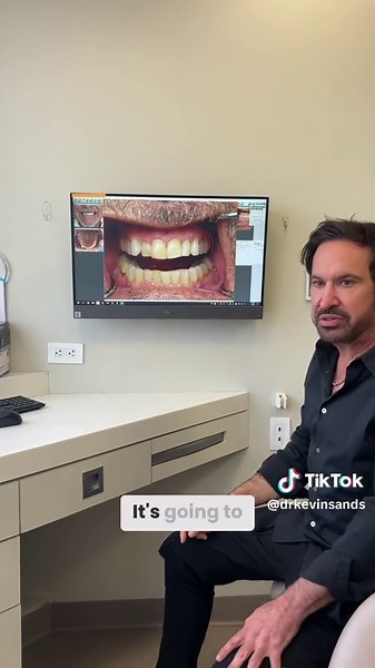 Full Smile Makeover with Kevin Sands Veneers